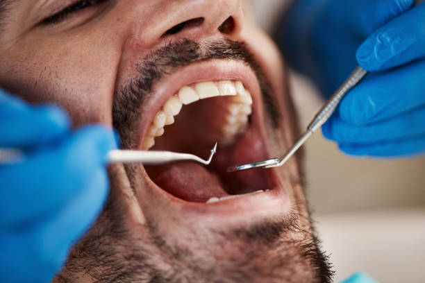 Best Tooth Infection Emergency Dentist  in Verona Walk, FL