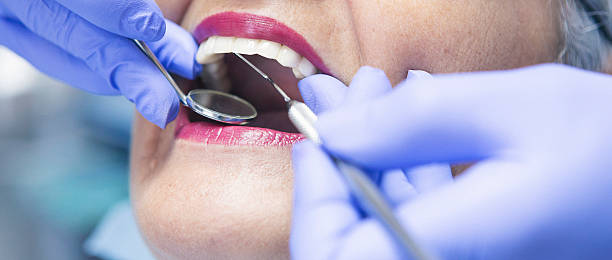 Best Chipped Tooth Repair Near Me  in Verona Walk, FL